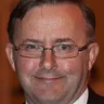 Anthony Albanese Politician voice for text-to-speech